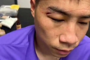 津媒：王献钧两颗门牙被撞断，杨帆眉骨受伤赛后去医院缝针